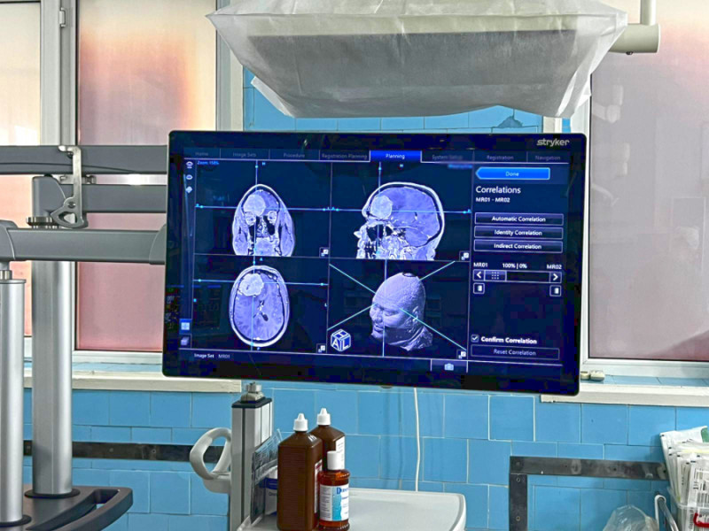 Primul spital din Galați a realizat operație pe creier cu neuronavigație