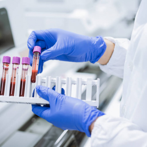 Cinci analize esențiale după 40 de ani pentru o sănătate optimă